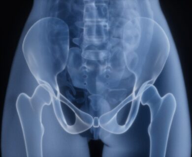 X-ray of a human pelvis and hips