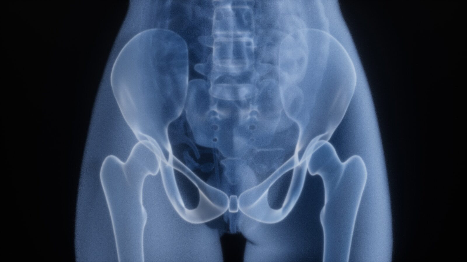 X-ray of a human pelvis and hips